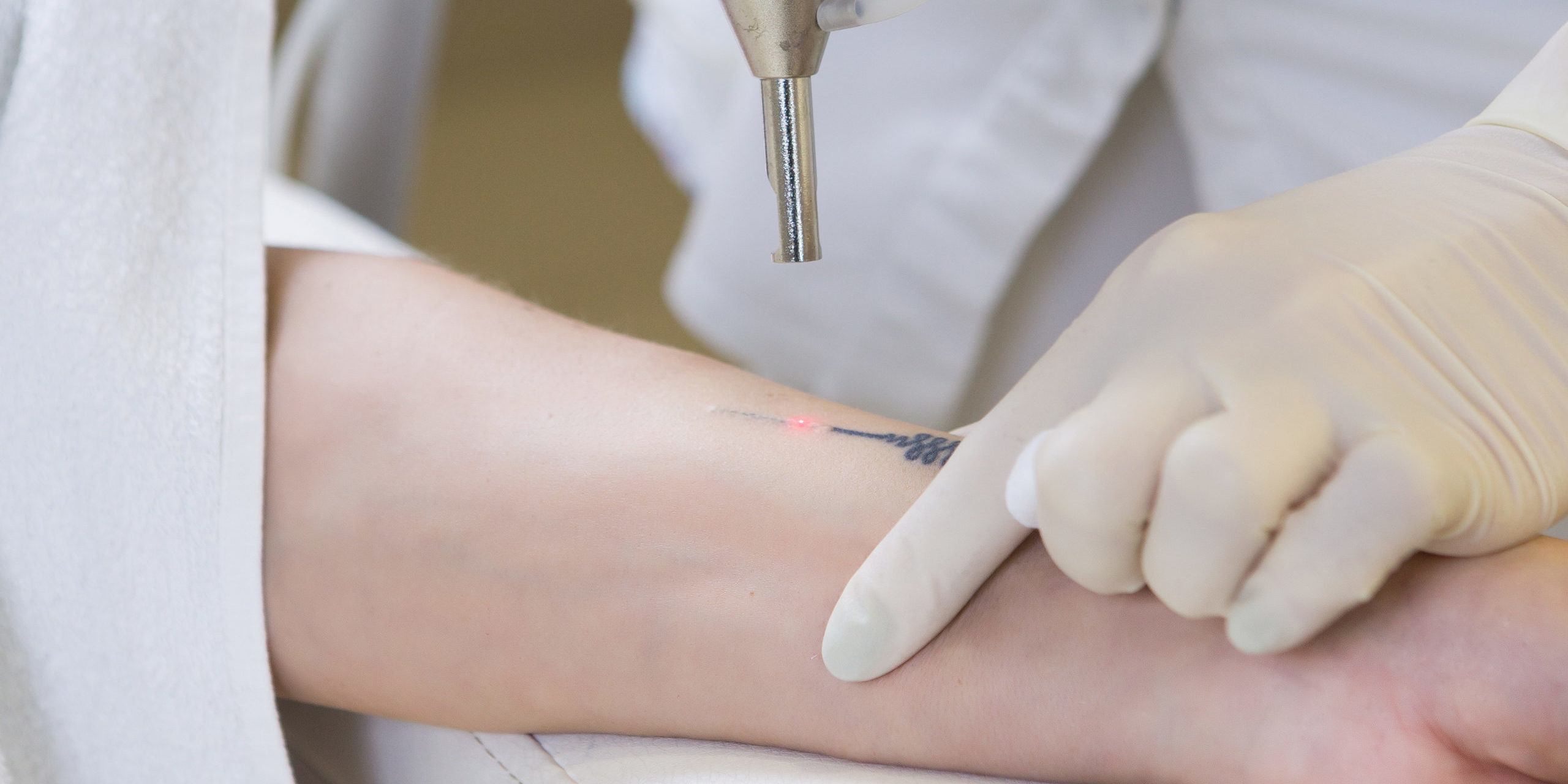 Laser Tattoo Removal  USF Health