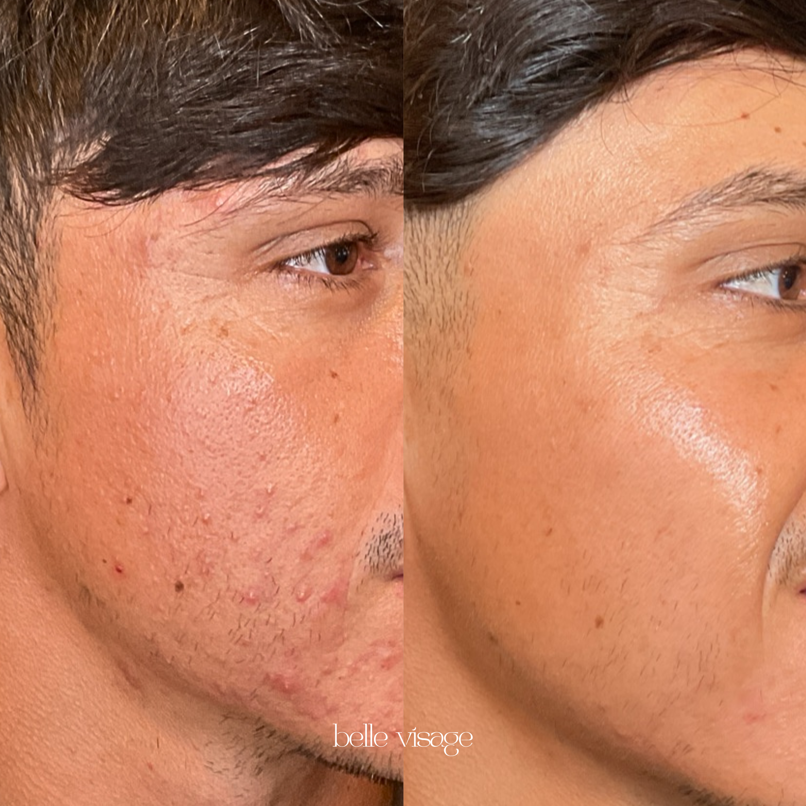 Before and After 4