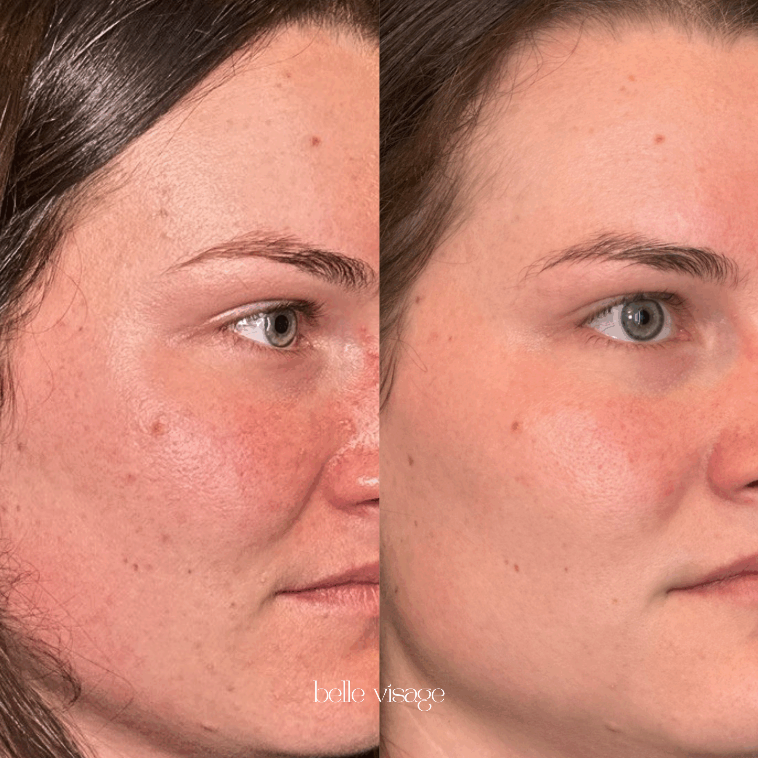 Before and After 3