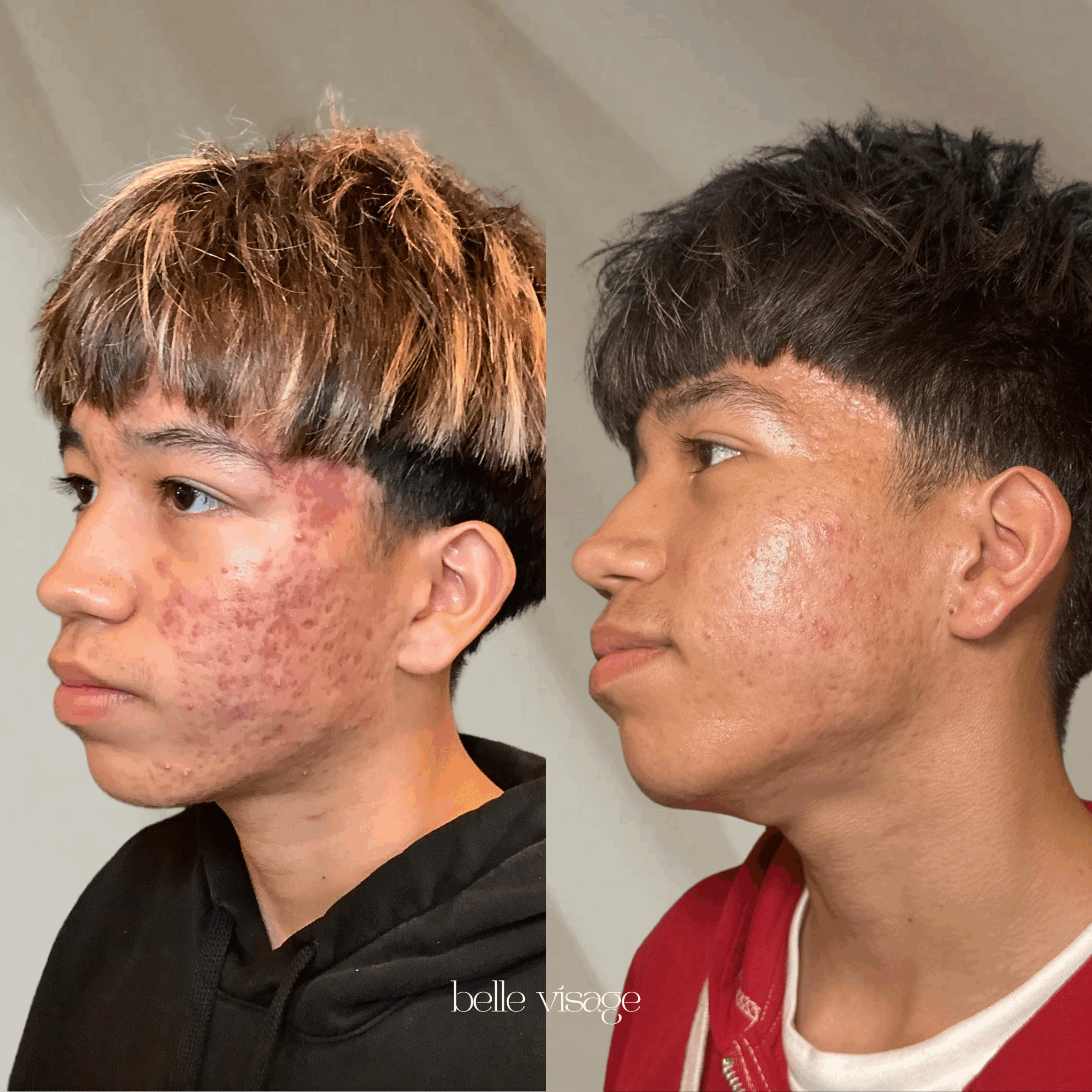 Before and After 2